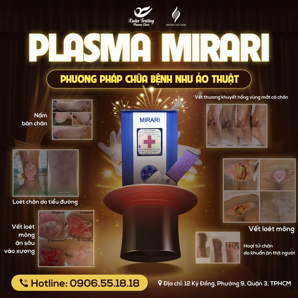 Những ca bệnh khó điều trị Mirari Plasma lạnh đã điều trị thành công được xem như một kỳ tích do đó Mirari plasma lạnh được xem như phương pháp chữa bệnh như ảo thuật.